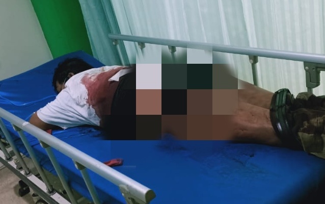 Berita Banten, Berita Tangerang, Berita Cilegon: Korban Penusukan di Star Queen Cilegon Bersimbah Darah
